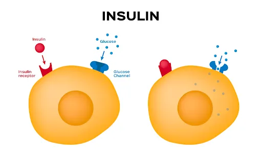 Cơ thể kháng insulin có thể dẫn đến bệnh buồng trứng đa nang